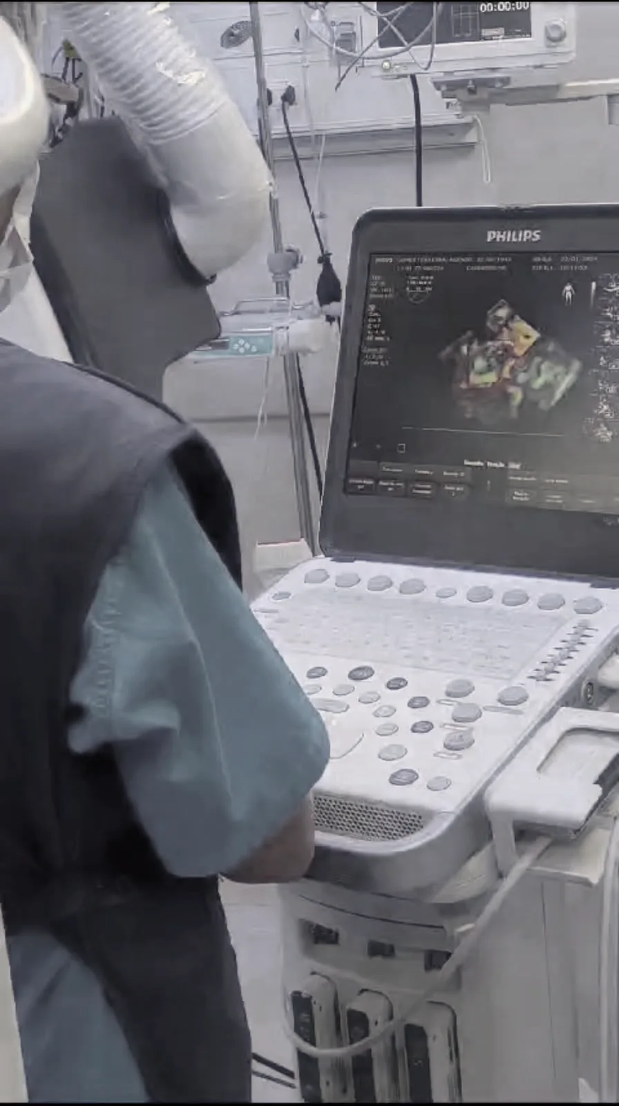 Dra. Roberta realizando ecocardiograma transesofágico no centro cirúrgico
